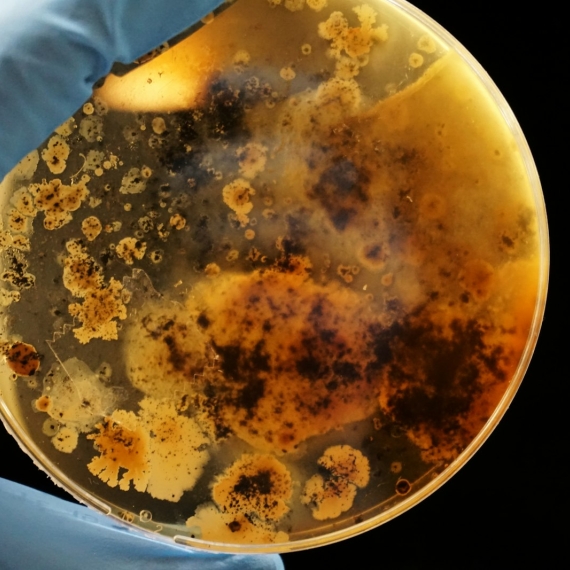 Hand met laboratoriumhandschoen houdt een petrischaal met bacteriekolonies vast